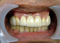 ���Ê���