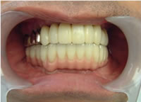 ���Ê���