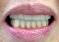 ���Ê���