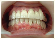 歯科治療症例